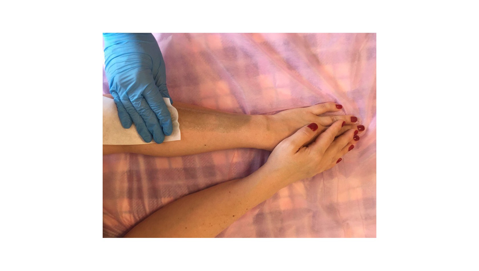 Восковая депиляция рук на дому в Киеве