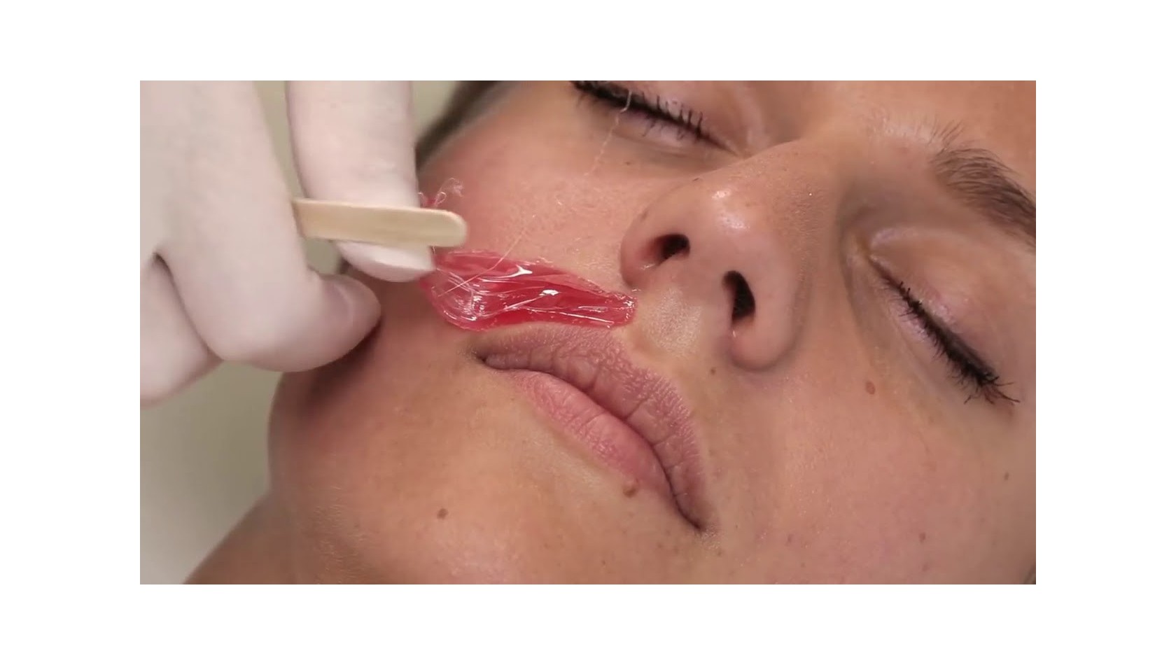 Восковая депиляция лица на дому